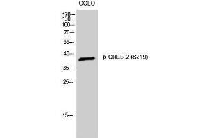 Western Blotting (WB) image for anti-Activating Transcription Factor 4 (Tax-Responsive Enhancer Element B67) (ATF4) (pSer219) antibody (ABIN3173148) (ATF4 抗体  (pSer219))