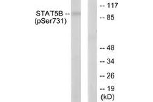 Western blot analysis of extracts from RAW264. (STAT5B 抗体  (pSer731))