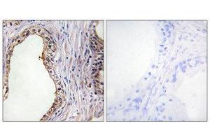 Immunohistochemistry (IHC) image for anti-Lecithin Retinol Acyltransferase (Phosphatidylcholine--Retinol O-Acyltransferase) (LRAT) (Internal Region) antibody (ABIN1849061) (LRAT 抗体  (Internal Region))
