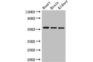 Western Blot Positive WB detected in: Mouse heart tissue, Mouse brain tissue, Mouse kidney tissue All lanes: SH3BP5 antibody at 3 μg/mL Secondary Goat polyclonal to rabbit IgG at 1/50000 dilution Predicted band size: 51, 33 kDa Observed band size: 51 kDa (SH3BP5 抗体  (AA 49-455))