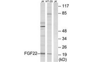 Western blot analysis of extracts from Jurkat/HT-29 cells, using FGF22 Antibody. (FGF22 抗体  (AA 71-120))