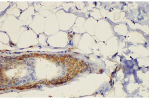 Immunohistochemistry of paraffin-embedded Rat skin using CD44 Polycloanl Antibody at dilution of 1:200 (CD44 抗体)