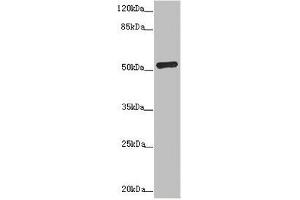 Western blot All lanes: ADPGK antibody at 1. (ADPGK 抗体  (AA 218-497))
