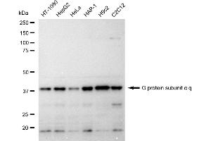Western blotting analysis using G protein subunit alpha q antibody (ABIN7800932). (Recombinant GNAQ 抗体)