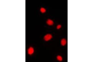 Immunofluorescent analysis of AKAP8 staining in Jurkat cells. (AKAP8 抗体  (Center))