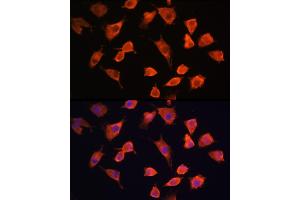 Immunofluorescence analysis of L929 cells using PFDN5 Rabbit pAb (ABIN1681328, ABIN3018415, ABIN3018416 and ABIN6220463) at dilution of 1:100 (40x lens). (PFDN5 抗体  (AA 1-154))