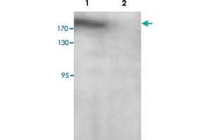 Western blot analysis of SK-OV-3 cell lysate with PARP14 polyclonal antibody  at 1 : 200 dilution. (PARP14 抗体  (C-Term))