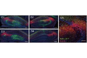 Representative confocal serial sections of hippocampus infected with AAV9/hSyn-Cre & AAV9/EF1α-DIO-EGFP (green) in dCA2 and stained with RGS14 ((ABIN1304934), 1:500, red). (RGS14 抗体  (AA 1-544))