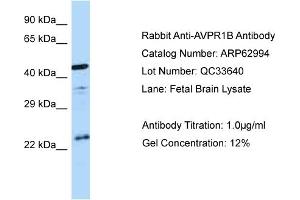 Western Blotting (WB) image for anti-Arginine Vasopressin Receptor 1B (AVPR1B) (C-Term) antibody (ABIN2774358) (AVPR1B 抗体  (C-Term))