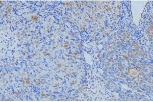 Immunohistochemistry (IHC) image for anti-Collagen, Type III, alpha 1 (COL3A1) (N-Term) antibody (ABIN6260942)