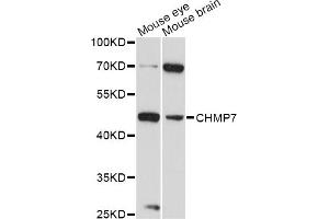 Western blot analysis of extracts of various cell lines, using CHMP7 antibody (ABIN6293246) at 1:3000 dilution. (CHMP7 抗体)