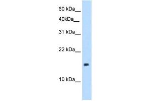 WB Suggested Anti-PAGE1 Antibody Titration:  5. (PAGE1 抗体  (Middle Region))