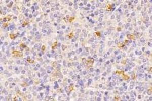 Immunohistochemistry (Paraffin-embedded Sections) (IHC (p)) image for anti-omega-3 Fatty Acid Receptor 1 (O3FAR1) antibody (ABIN7074942)