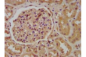 Immunohistochemistry (IHC) image for anti-Wingless-Type MMTV Integration Site Family, Member 9B (WNT9B) (AA 213-324) antibody (ABIN7166320)
