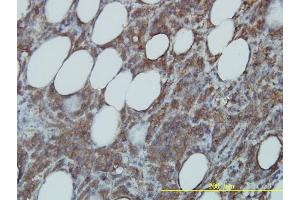 Immunostaining (ISt) image for anti-Cell Division Cycle 37 Homolog (S. Cerevisiae) (CDC37) (AA 1-378) antibody (ABIN564833)