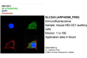 Image no. 2 for anti-Solute Carrier Family 2 (Facilitated Glucose/fructose Transporter), Member 5 (SLC2A5) (Middle Region) antibody (ABIN2777140) (SLC2A5 抗体  (Middle Region))