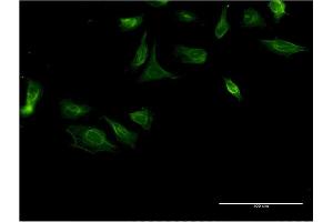 Immunofluorescence of monoclonal antibody to ITGA4 on HeLa cell. (ITGA4 抗体  (AA 98-207))