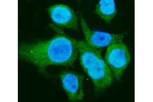 IF analysis of CA1 using anti-CA1 antibody (ABIN3043766).