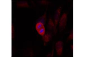 Image no. 2 for anti-Mitogen-Activated Protein Kinase Kinase 4 (MAP2K4) (Thr261) antibody (ABIN197323) (MAP2K4 抗体  (Thr261))