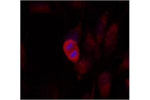 Image no. 2 for anti-Mitogen-Activated Protein Kinase Kinase 4 (MAP2K4) (Thr261) antibody (ABIN197322)