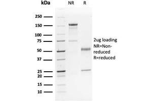 SDS-PAGE Analysis Purified p63 Mouse Monoclonal Antibody (TP63/2428).