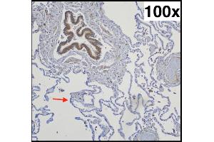 Typical pulmonal findings in AQP-5 (aquaporin-5) immunohistochemistry (right lower lobe, 73-year-old woman with chronic emphysema): Strongly positive bronchial epithelium (upper left corner) next to negative pneumocytes type I (exemplary marked with an arrow) Source: PMID34181078 (Aquaporin 5 抗体  (AA 201-265) (Biotin))