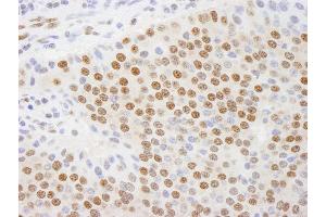 Immunohistochemistry (IHC) image for anti-C-terminal Binding Protein 1 (CTBP1) (AA 400-440) antibody (ABIN7448499)