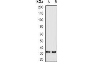 Western blot analysis of WBSCR22 expression in H460 (A), A549 (B) whole cell lysates. (WBSCR22 抗体)