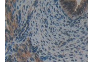 Immunohistochemistry (IHC) image for anti-Glutathione S-Transferase kappa 1 (GSTK1) (AA 19-222) antibody (ABIN7440020)