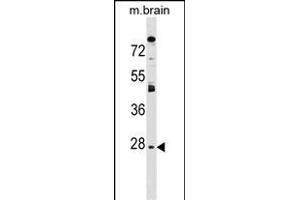 AQP1 Antibody (C-term) (ABIN1536913 and ABIN2849410) western blot analysis in mouse brain tissue lysates (35 μg/lane). (Aquaporin 1 抗体  (C-Term))