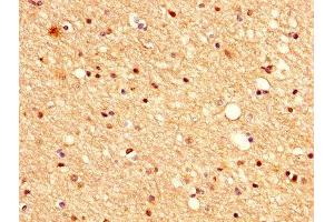 IHC image of ABIN7175396 diluted at 1:500 and staining in paraffin-embedded human brain tissue performed on a Leica BondTM system. (VASH1 抗体  (AA 1-204))