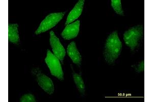 Immunofluorescence (IF) image for anti-Eukaryotic Translation Initiation Factor 4E Nuclear Import Factor 1 (EIF4ENIF1) (AA 886-985) antibody (ABIN527921)