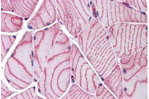 Human Skeletal Muscle: Formalin-Fixed, Paraffin-Embedded (FFPE) (ACTN2 抗体  (AA 215-500))