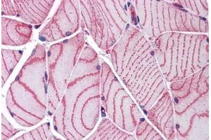 Human Skeletal Muscle: Formalin-Fixed, Paraffin-Embedded (FFPE) (ACTN2 抗体  (AA 215-500))
