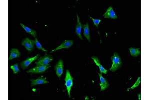 Immunofluorescence (IF) image for anti-Annexin A2 (ANXA2) (AA 2-339) antibody (ABIN7144268)