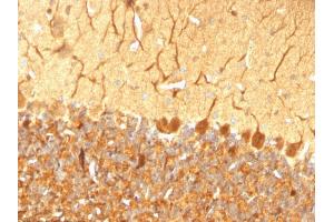 Formalin-fixed, paraffin-embedded Rat Cerebellum stained with Pgp9.