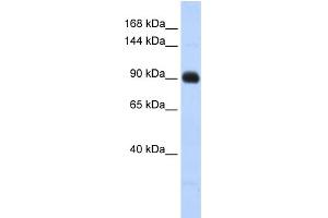 WB Suggested Anti-MATN2 Antibody Titration: 0. (MATN2 抗体  (Middle Region))