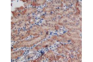 Used in DAB staining on fromalin fixed paraffin- embedded kidney tissue (GALNS 抗体  (AA 168-377))