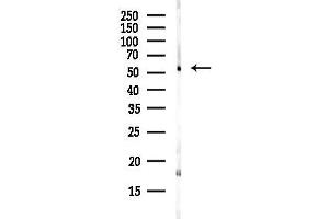 Western blot analysis of lysates from HepG2 cells(starvation,24h treatment), using DLD Antibody at 1/1000 dilution.
