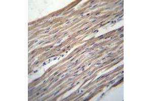 Immunohistochemistry analysis in formalin fixed and paraffin embedded human heart tissue reacted with HRC / HCR Antibody (Center) followed which was peroxidase conjugated to the secondary antibody and followed by DAB staining. (HRC 抗体  (Middle Region))