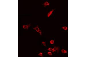 Immunofluorescence (fixed cells) (IF/ICC) image for anti-ATP Synthase, H+ Transporting, Mitochondrial F1 Complex, alpha Subunit 1, Cardiac Muscle (ATP5A1) (Internal Region) antibody (ABIN6258538)