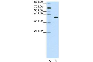 WB Suggested Anti-PGBD1 Antibody Titration:  1. (PGBD1 抗体  (N-Term))
