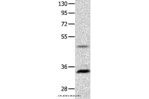 Western blot analysis of Mouse intestinum tenue tissue  , using MC1R Polyclonal Antibody at dilution of 1:1450 (MC1 Receptor 抗体)