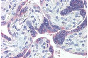 Placenta, Human: Formalin-Fixed, Paraffin-Embedded (FFPE) (PDIA3 抗体)