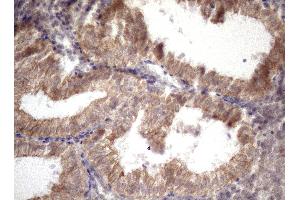 Immunohistochemistry (IHC) image for anti-Amelotin (AMTN) antibody (ABIN2716038) (Amelotin 抗体)
