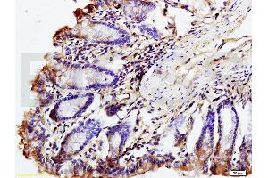 Formalin-fixed and paraffin embedded mouse intestine labeled with Rabbit Anti phospho-GCN2 (Thr667) Polyclonal Antibody, Unconjugated (ABIN684958) at 1:200 followed by conjugation to the secondary antibody and DAB staining (GCN2 抗体  (pThr667))