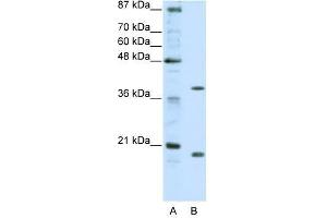 ZNF322A antibody used at 0. (ZNF322A 抗体  (C-Term))