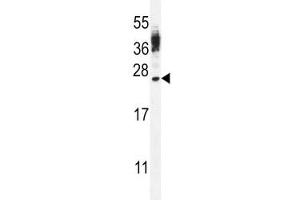CT45A antibody western blot analysis in WiDr lysate (CT45A3 抗体  (AA 106-135))