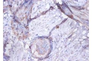 Immunohistochemistry of paraffin-embedded human prostate tissue using ABIN7154292 at dilution of 1:100 (GOLM1 抗体  (AA 36-401))