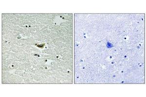 Immunohistochemical analysis of paraffin-embedded human brain tissue using CK-1α (Phospho-Tyr294) antibody (left)or the same antibody preincubated with blocking peptide (right). (CSNK1A1 抗体  (pTyr294))
